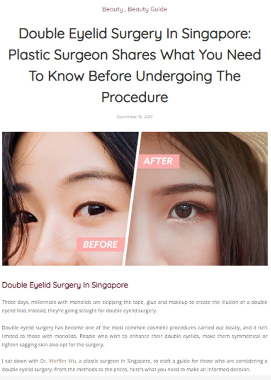 Double Eyelid Surgery